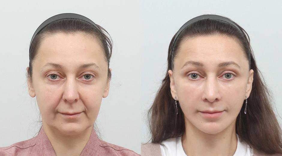 AB Plastic Surgery