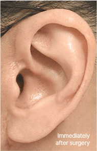 Skill matters in post-surgery scarring too. 2